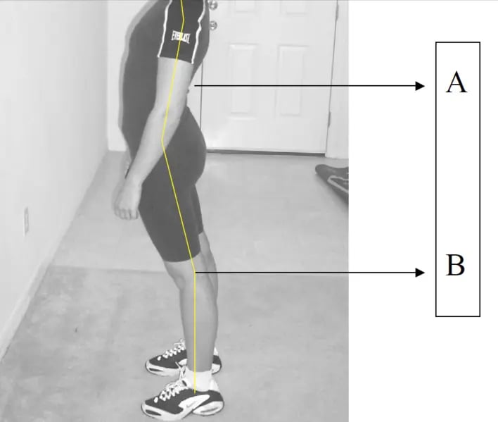 Image of lumbar lordosis