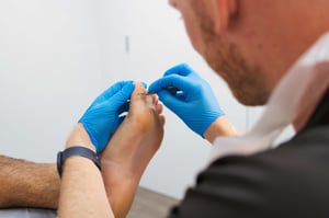 do-you-need-to-see-a-podiatrist-for-corns-and-calluses-on-your-foot