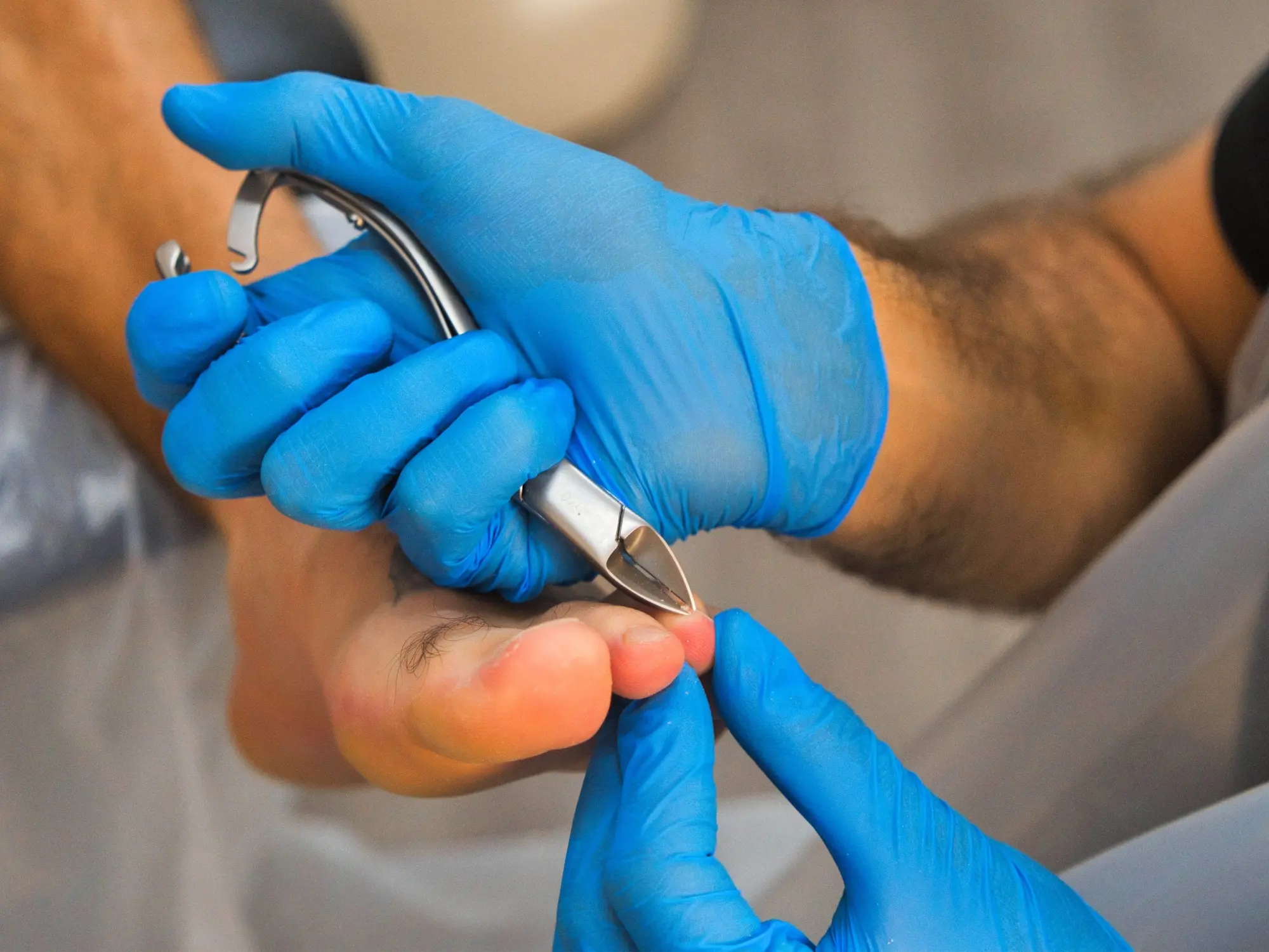 Step 2: Routine Care and Foot Hygiene