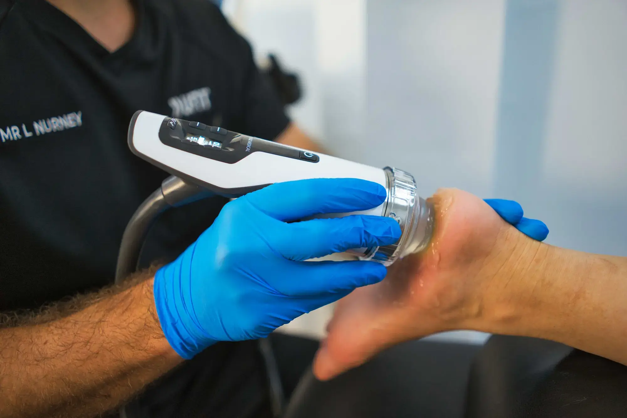 Podiatry shockwave - Heel focal shockwave treatment